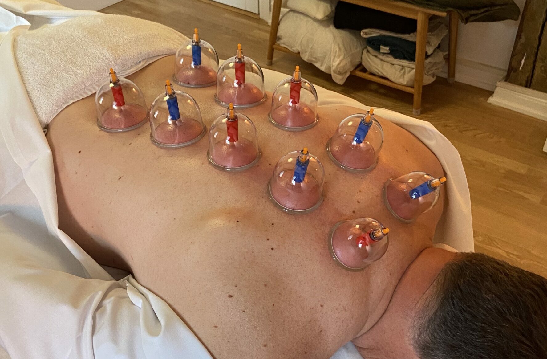 Cupping, Tid til Massage, Aarhus.